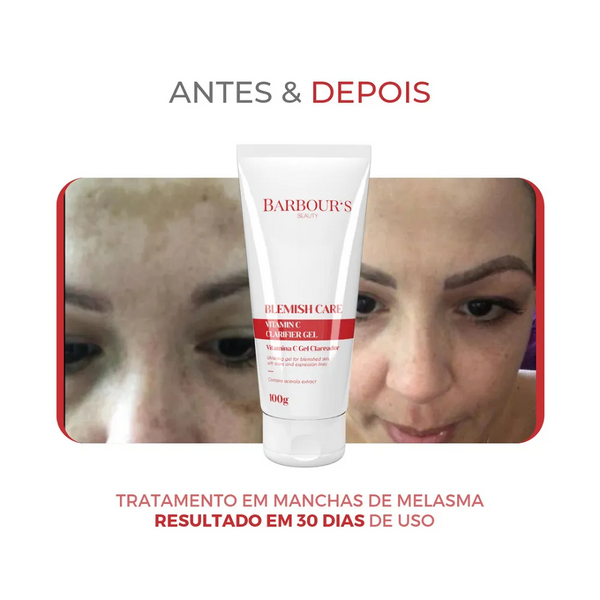 Radiant Glow Brightening Gel