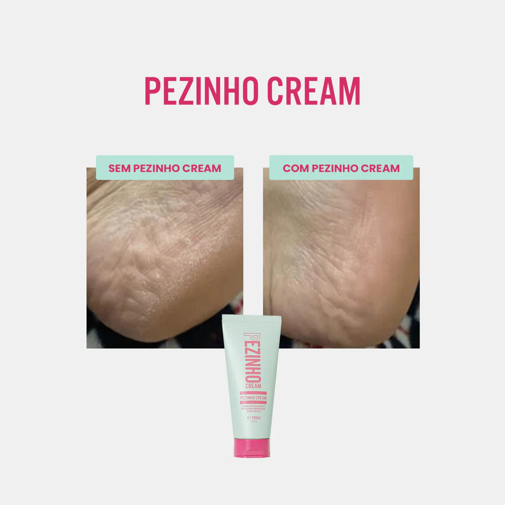 Pezinho Cream - 100g