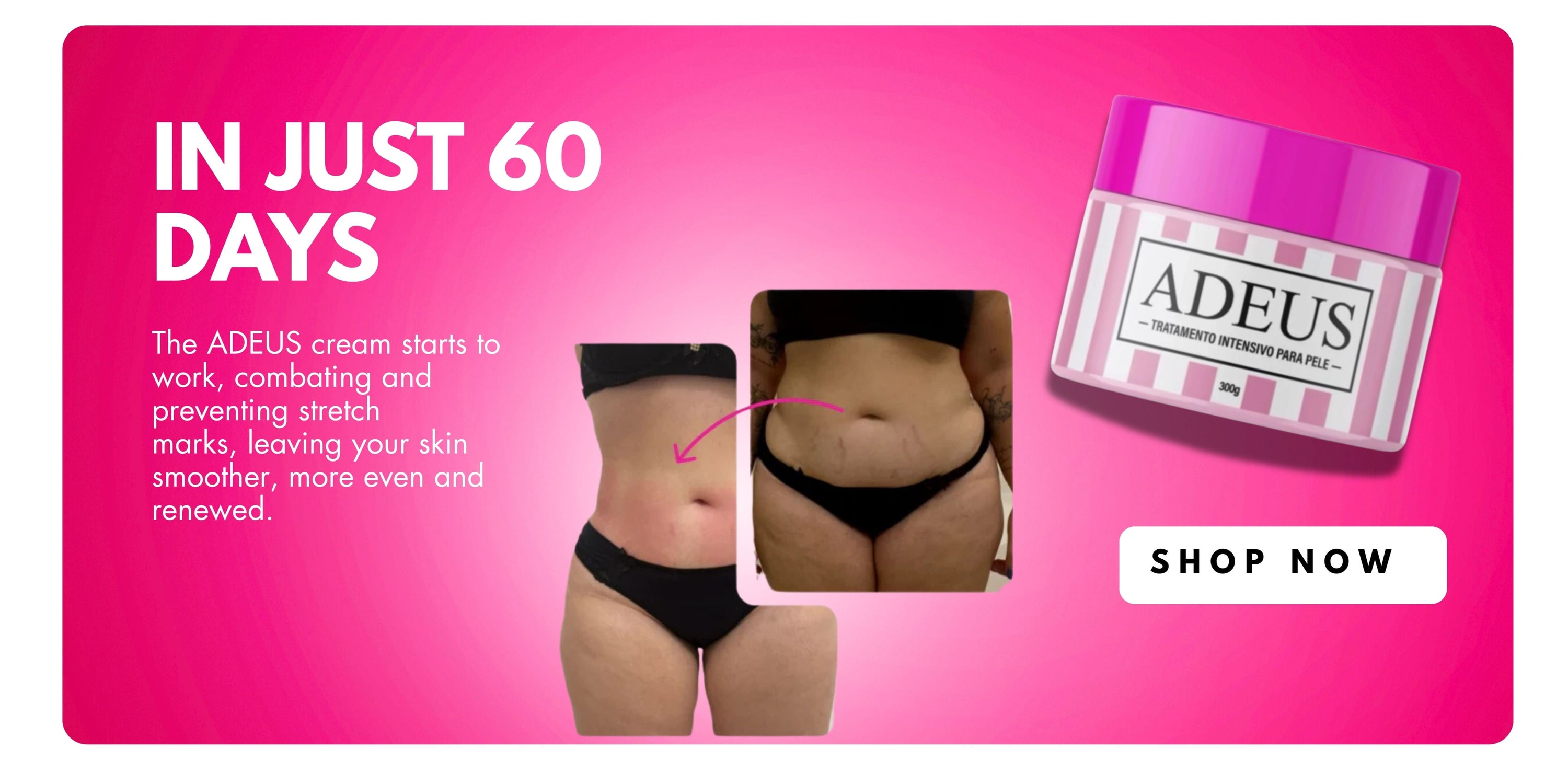 Advertisement for ADEUS cream showing before and after effects on a pink background