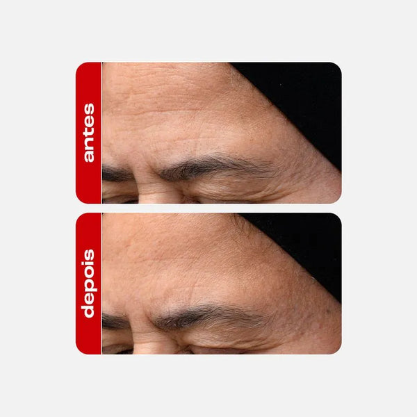 Anti-ageing serum - Retinol