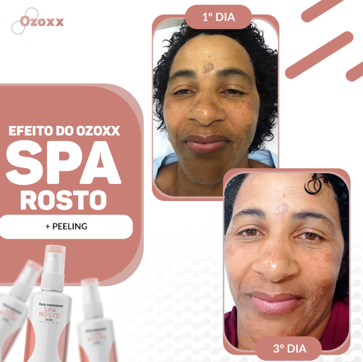 oleo ozonizado Ozoxx Spa Rosto 30ml