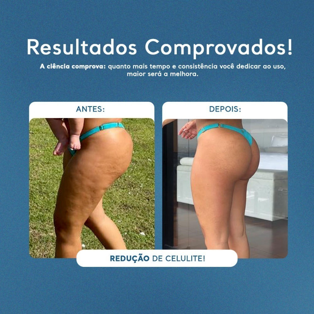 Gel Redutor de Medidas, Celulites e Flacidez - 200g