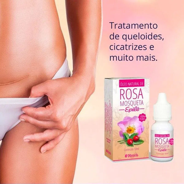 Pure Natural Oil Rosa Mosqueta Epile 10ml